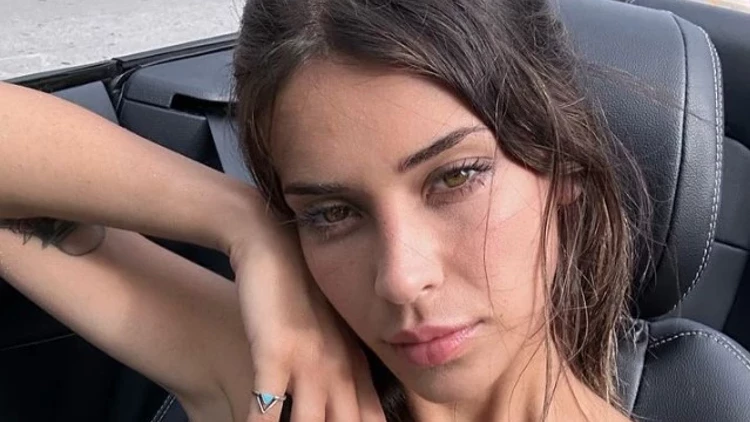 "Heç bir estetik əməliyyatım yoxdur"