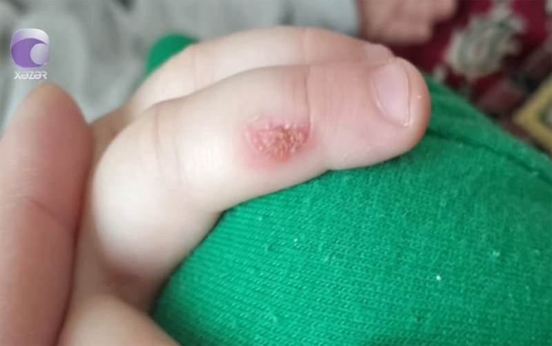 Bakıda tərbiyəçi 3 yaşlı uşağın əlinə dağ basıb &ndash; İDDİA/VİDEO