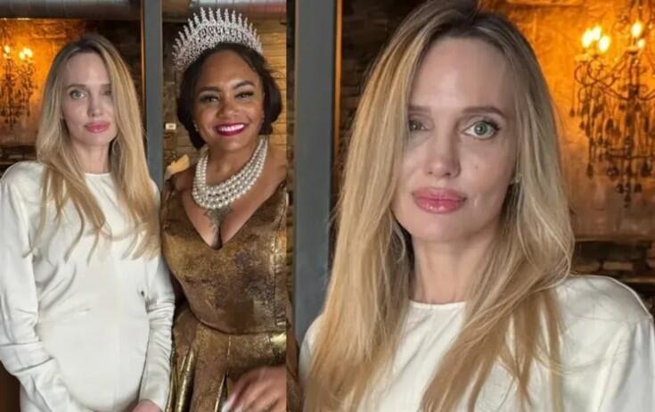 Colinin gözünə nə olub? - FOTO