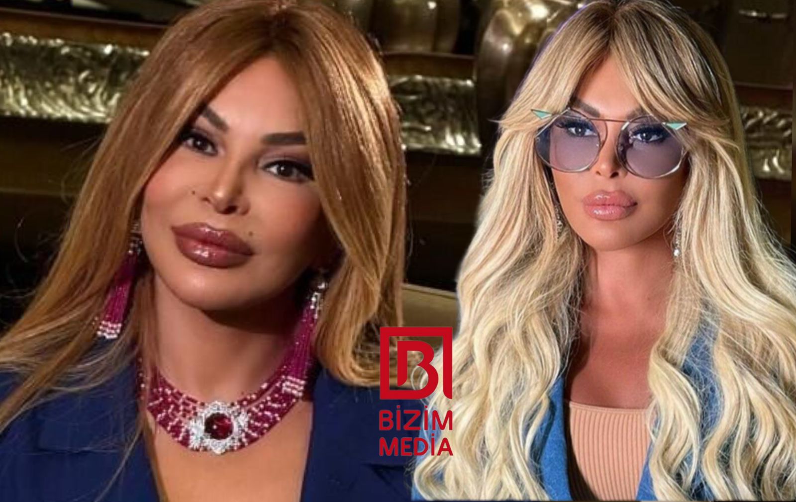 Aygün Kazımovanın səhhətində PROBLEM YARANDI - FOTO