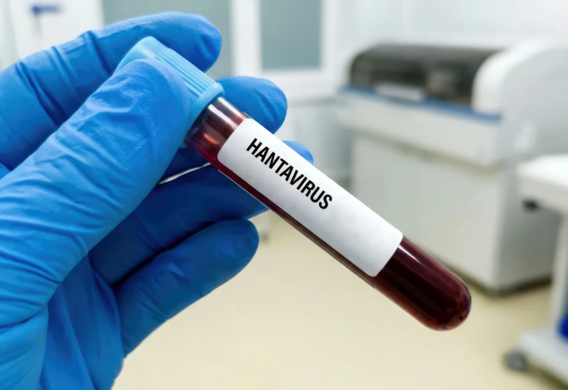 Ölümcül infeksiya əlamətləri olan Hantavirus nədir? - Dünya yenidən təşviş içində