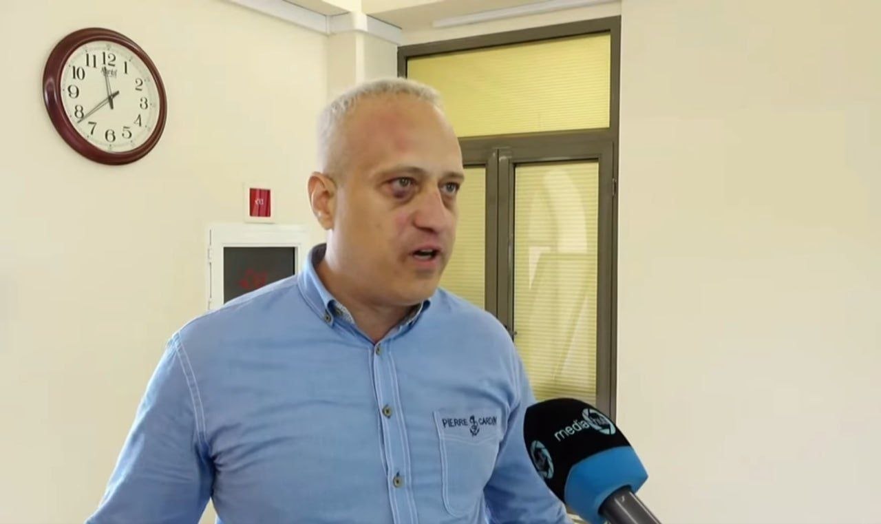 İrəvandankı davada müxalifətçi deputatın gözü partladıldı - VİDEO İrəvandankı davada müxalifətçi deputatın gözü partladıldı - VİDEO