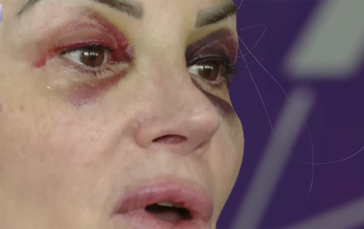 “Mən ondan həmişə qorxmuşam...”- Həmin kişi eks-iş yoldaşı imiş – Video “Mən ondan həmişə qorxmuşam...”- Həmin kişi eks-iş yoldaşı imiş – Video