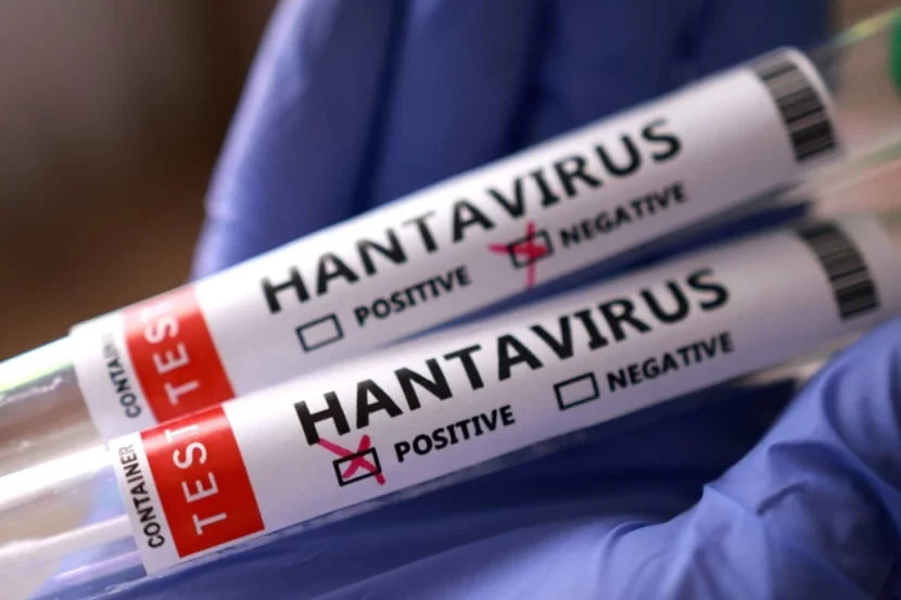 Venesuelada hantavirus həyəcanı: Ölənlər var Venesuelada hantavirus həyəcanı: Ölənlər var