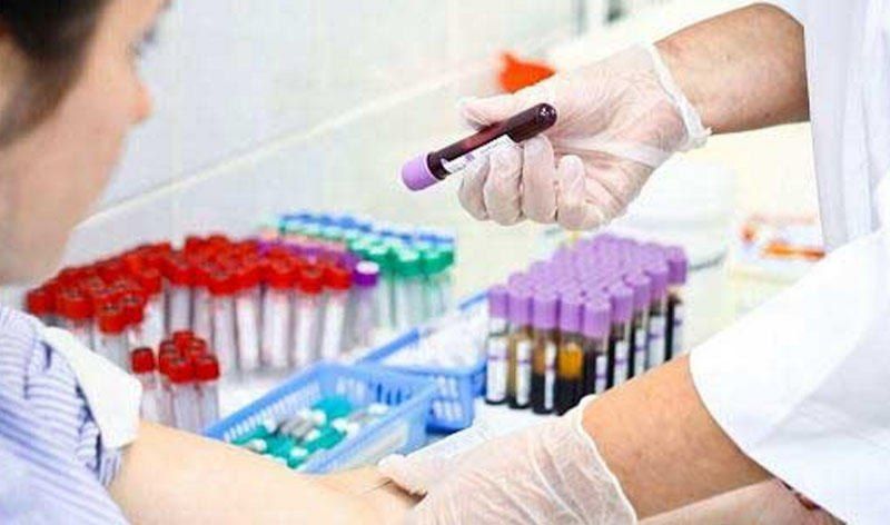 Bu il hepatit diaqnozu qoyulanların sayı AÇIQLANDI