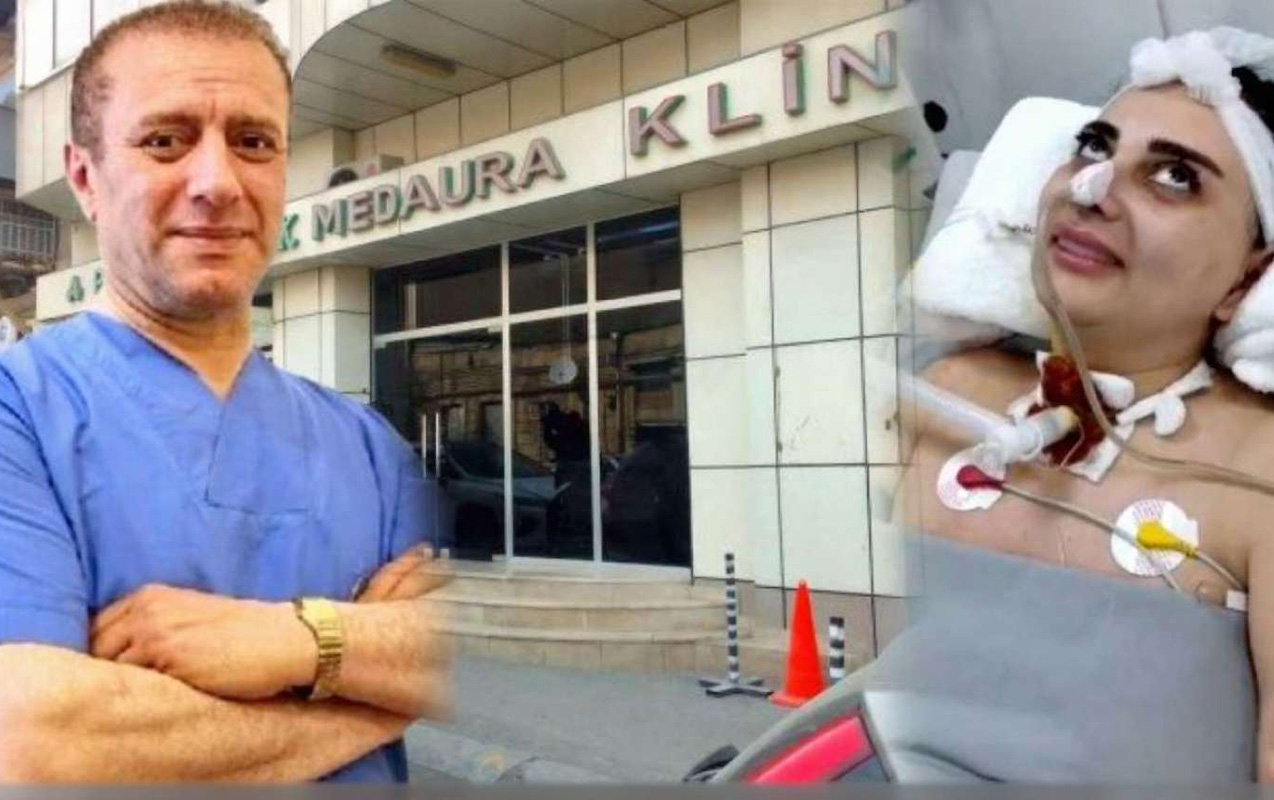 Xəstənin komaya düşməsində ittiham olunan estetik cərrah və anestezioloqa HÖKM OXUNDU