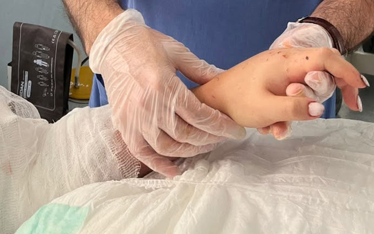 Bakıda qızın qopmuş qolu yerinə bərpa olundu- Foto