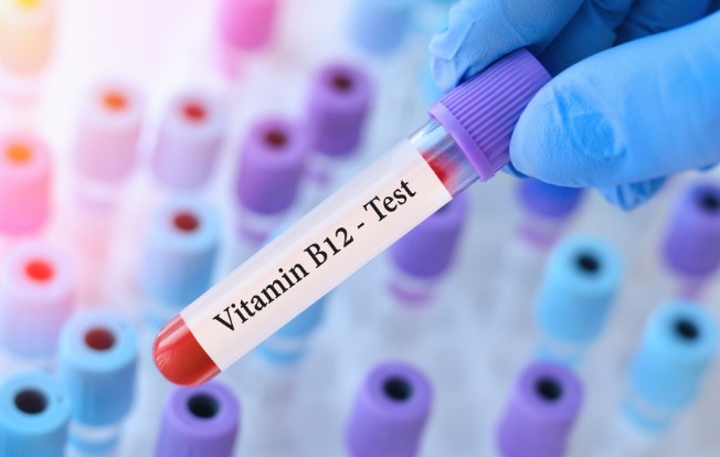 Qanında B12 vitamini yüksək olanlara XƏBƏRDARLIQ