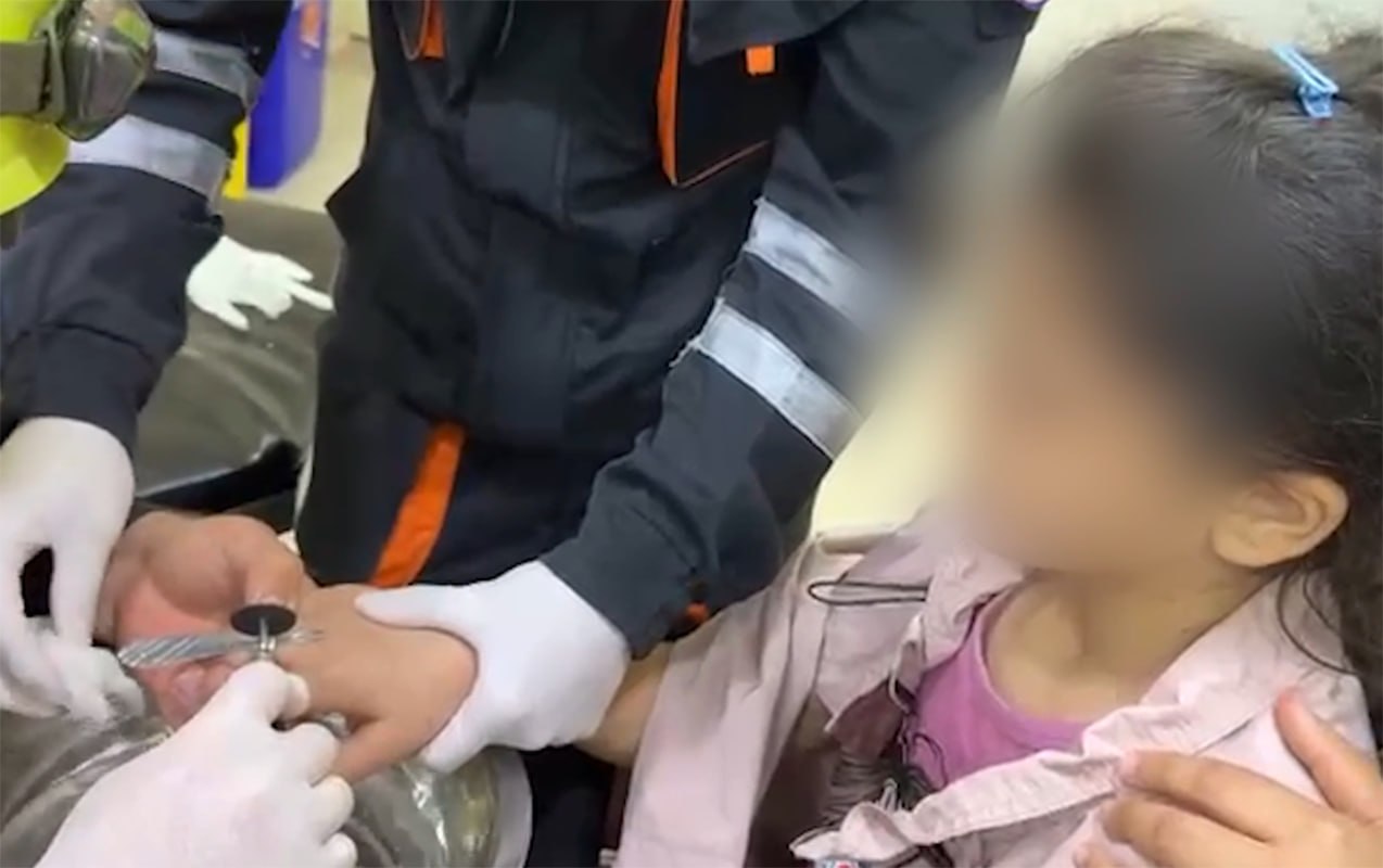 Barmağında üzük sıxılı qaldı: Belə xilas olundu - VİDEO