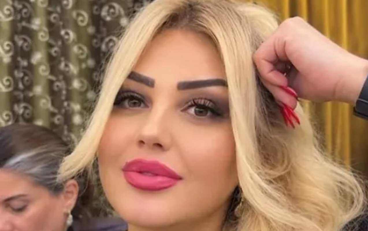 Bakıda qadın dişini çəkdirdiyinə görə vəfat edib? &ndash; Video