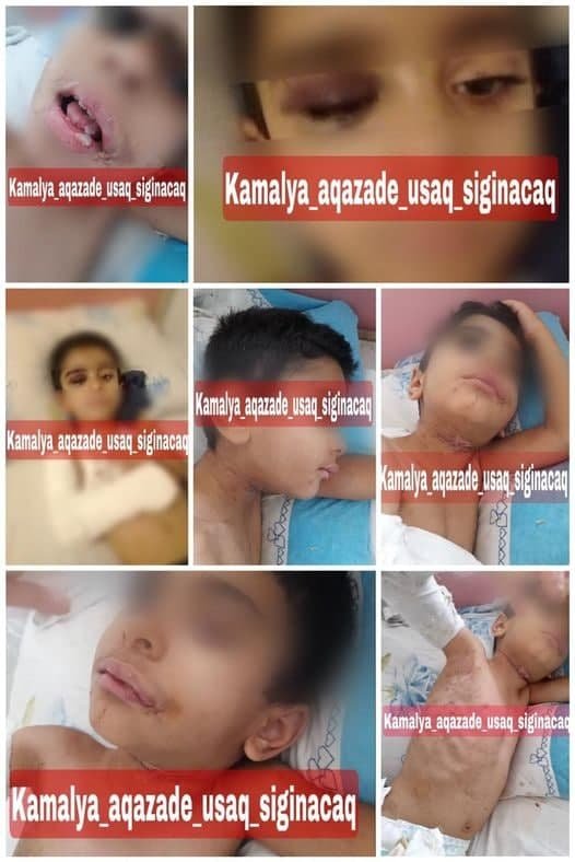 5 yaşlı uşağa işgəncə verən ana və tanışı saxlanıldı – YENİLƏNİB - FOTO - foto 1