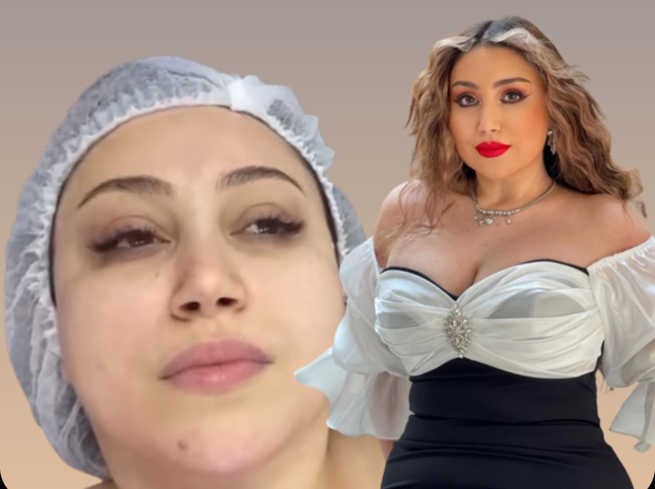Damla 9 saatlıq plastik əməliyyatından DANIŞDI: “Sinə ölçümü və ...” - VİDEO 