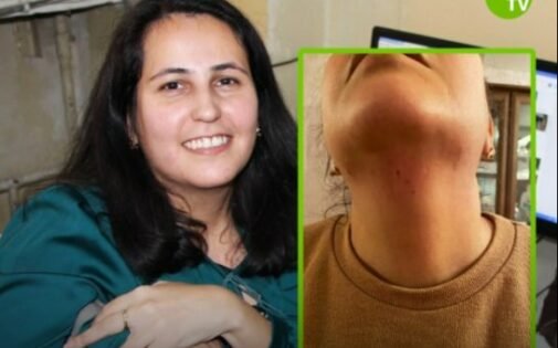 Aytən Məmmədovaya hücumla bağlı cinayət işinin istintaqı BŞBPİ-ə verildi 