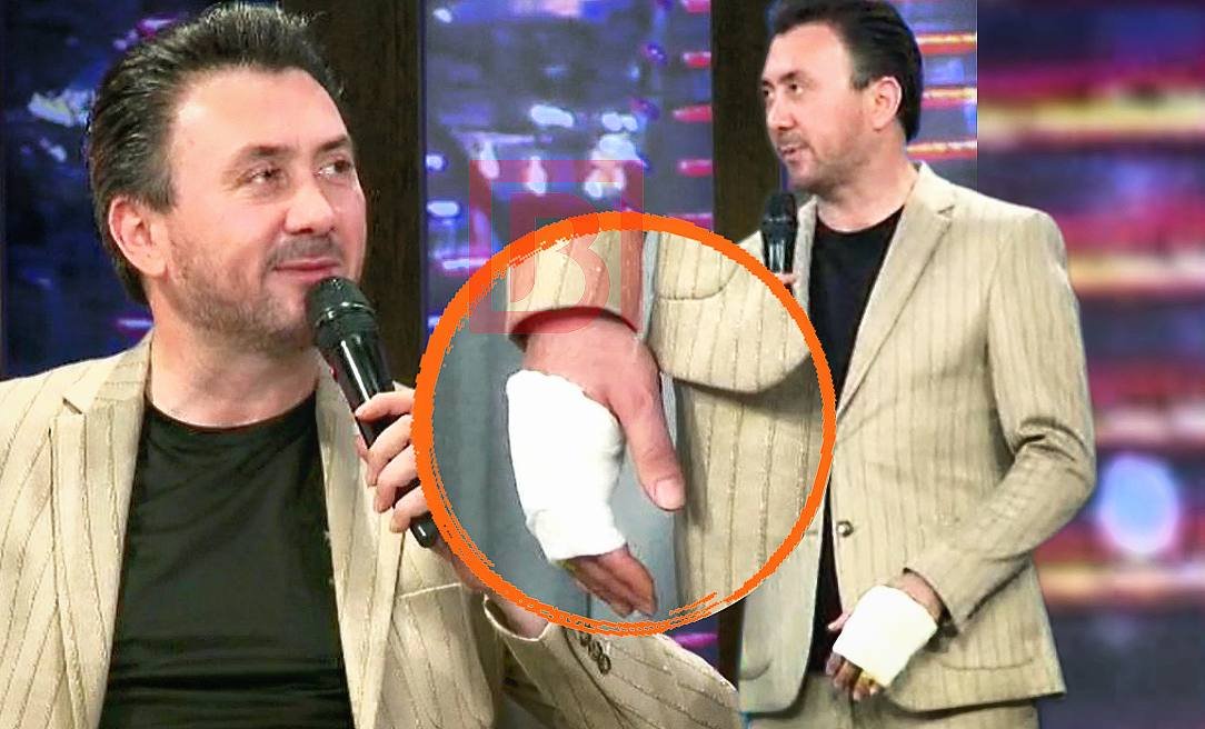 Restoranında dava düşən Aqşin canlı efirə sınıq barmaqla gəldi – VİDEO Restoranında dava düşən Aqşin canlı efirə sınıq barmaqla gəldi – VİDEO