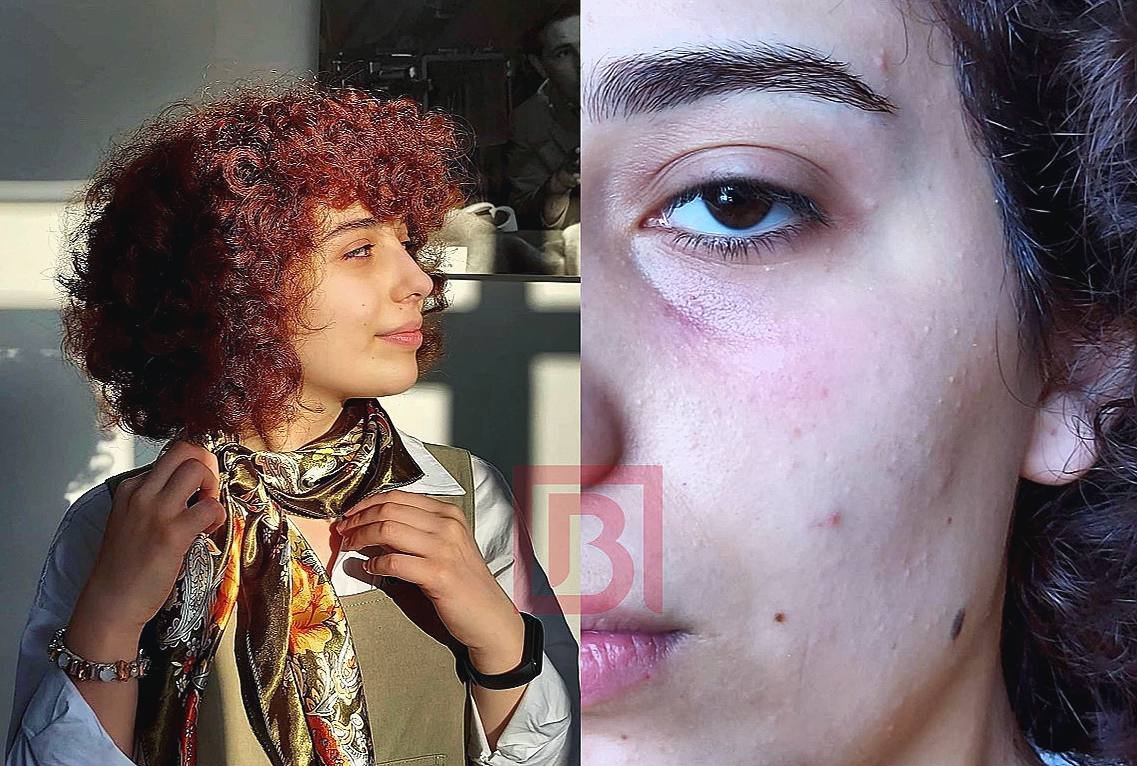 Gənc aktrisa onu döyən şəxsi bağışladı: 