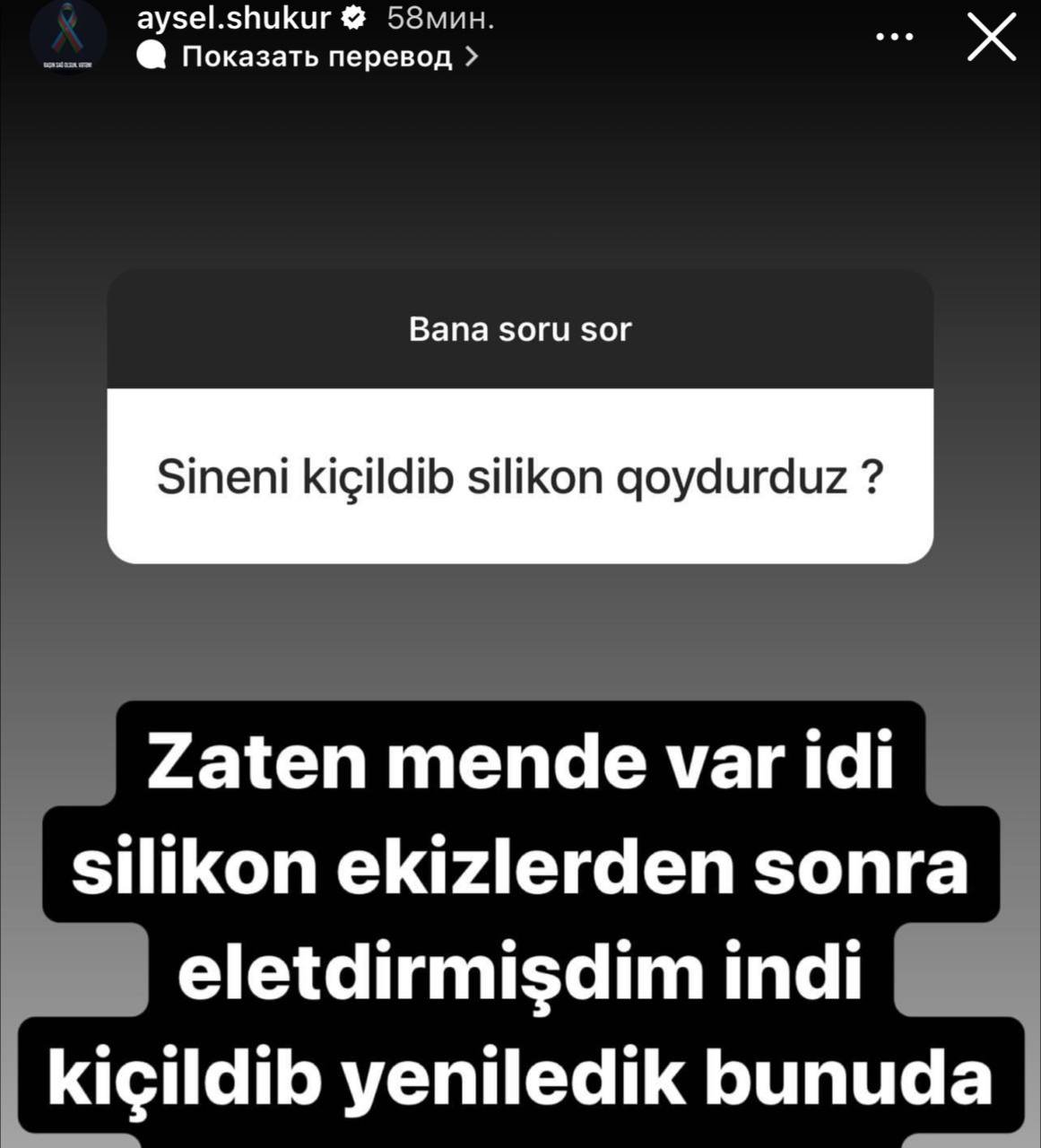 Aysel Şükür plastik əməliyyat etdirdi - FOTO - foto 1