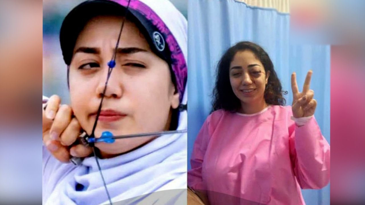 İranda qadın idmançı etirazlarda bir gözünü itirdi İranda qadın idmançı etirazlarda bir gözünü itirdi