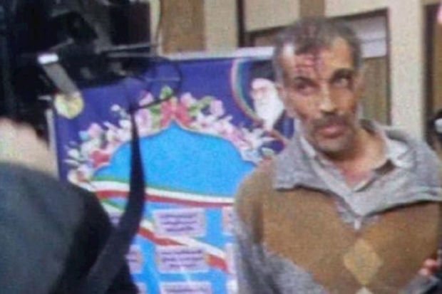 İrandakı səfirliyimizə hücum edən şəxsin görüntüsü yayıldı - FOTO