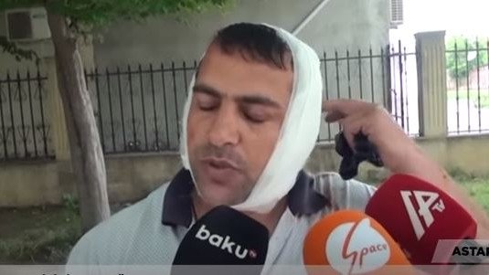 “Bir də gördüm, qulağım yoxdur…” – Qulağını eşşək qopardan kişi danışdı + VİDEO