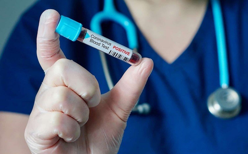 Penitensiar müəssisələrə giriş üçün COVID-19 testi tələbi LƏĞV OLUNUR 