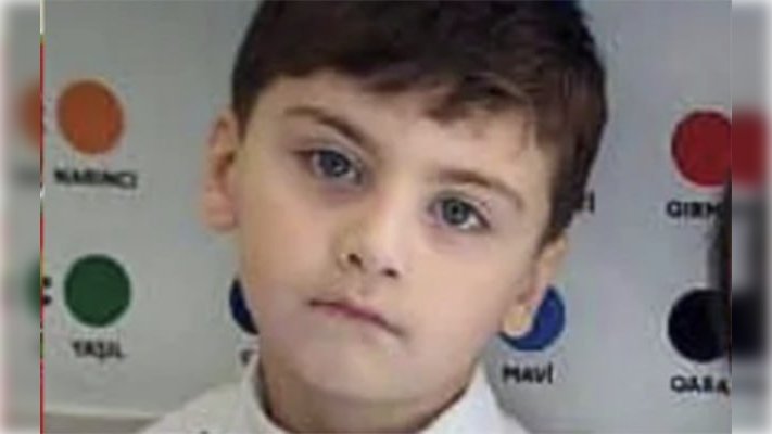 Faciəvi şəkildə ölən 5 yaşlı Aminin FOTOSU