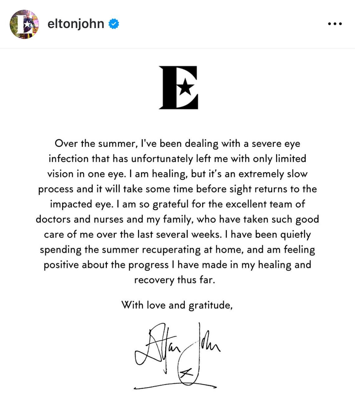 Elton Conun bir gözü kor olub - FOTO - foto 1