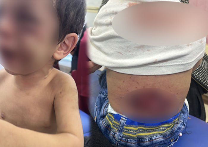 2 yaşlı uşağı döyüb yandıran atalığı HƏBS EDİLDİ - FOTO - foto 1