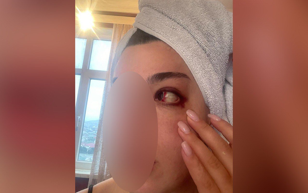 Eks-sevgilisindən Hidayətə ittihamlar - “550 min pulumu ələ keçirib, məni dəfələrlə döyüb” - FOTO - foto 2