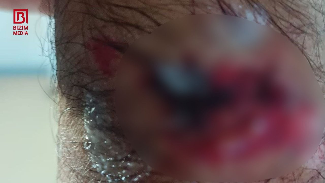 Ucarda sahibsiz itlər 61 yaşlı kişiyə hücum etdi – FOTO/VİDEO - foto 2