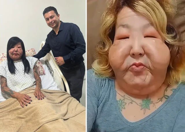 Gözəl olmaq istədi, tanınmaz hala düşdü – ŞOK FOTOLAR - foto 2