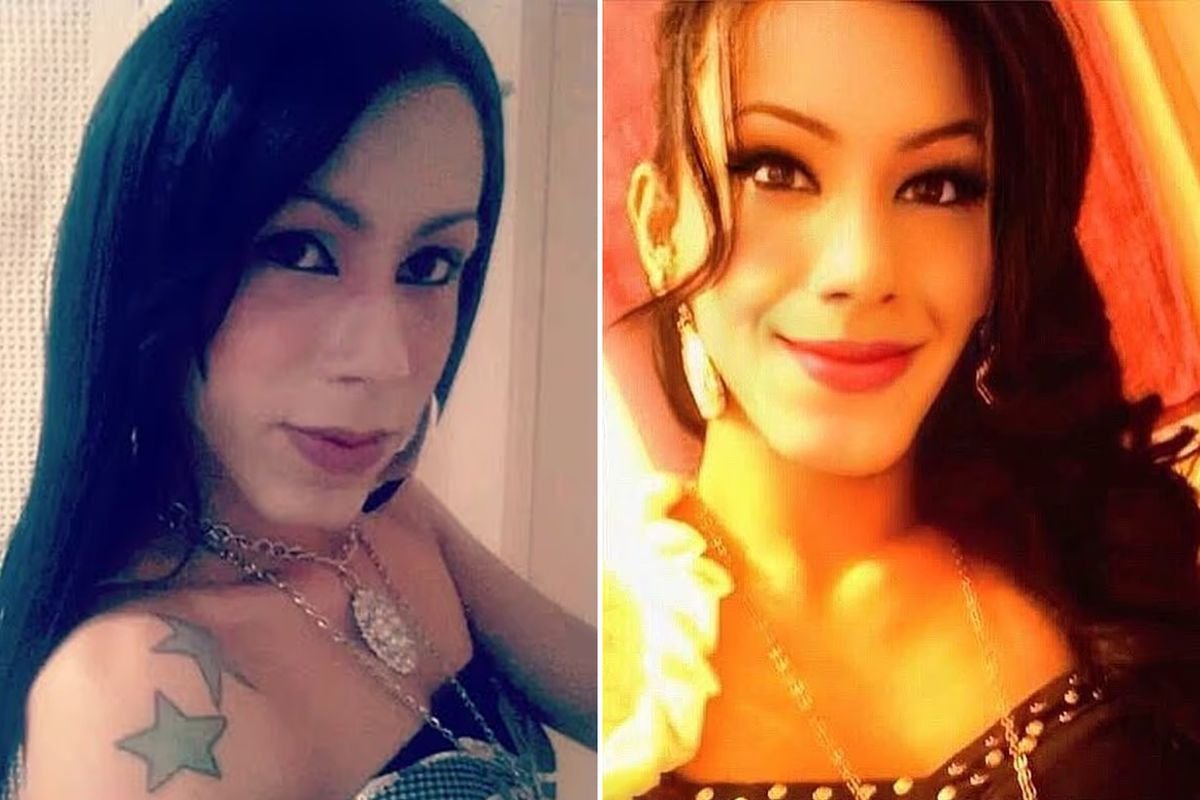 Gözəl olmaq istədi, tanınmaz hala düşdü – ŞOK FOTOLAR - foto 1