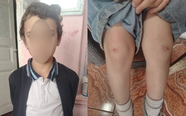 İki şagirdin məktəbin ayaqyolunda mütəmadi döyülməsi ilə bağlı RƏSMİ AÇIQLAMA