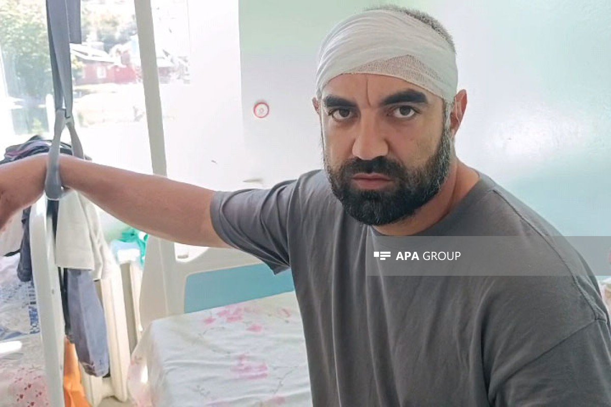 PUA hücumu nəticəsində yaralanan Azərbaycan vətəndaşlarının son durumu - FOTO - foto 4