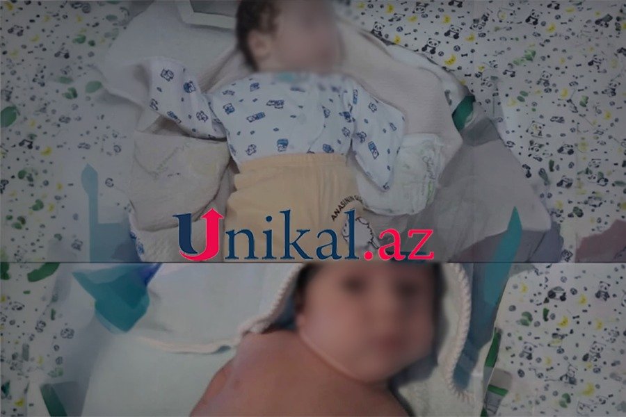 Bakıda ana qolları olmayan körpəsindən imtina etdi - FOTO - foto 1