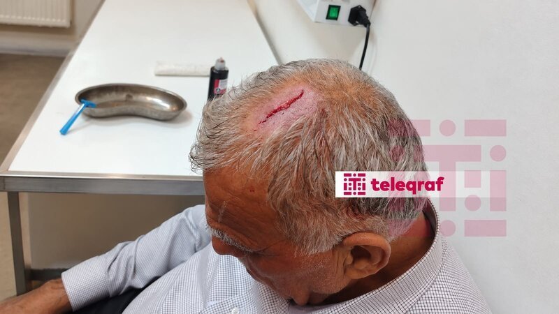 Şəkidə icra nümayəndəsi sədrin başına butulka çırpdı - Foto - foto 1