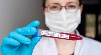 Azərbaycanda son sutkada 32 nəfər koronavirusdan ölüb
