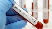 Dünyada daha 555 min nəfər koronavirusa yoluxdu