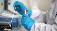 Azərbaycanda son sutkada 13 nəfər koronavirusa yoluxdu - 1 nəfər öldü