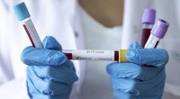 Azərbaycanda son gündə 585 nəfər koronavirusa yoluxdu - 1 xəstə öldü