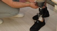352 hərbçi yüksək texnologiyalı protezlərlə təmin edilib