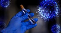 Koronavirusun fəsadları hələ 10-15 il sonra ÜZƏ ÇIXACAQ – Ekspertdən QORXULU PROQNOZ