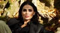 Günel Zeynalovanın qaşına 7 TİKİŞ QOYULDU – FOTO