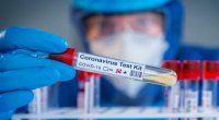 Koronavirusdan ölənlərin sayı 61% AZALIB