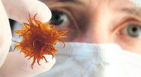Rusiyada naməlum virus YAYILIR – Həftələrlə davam edən öskürək, boğazdan qan gəlməsi...