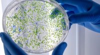 Dünyada yeni virus təhlükəsi- Fransada fövqəladə vəziyyət elan olundu