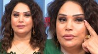 Mənzurə həkimdən şikayətçidir: “Üzümün bir tərəfini dartıb, o birini yox” - VİDEO
