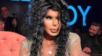 Bülent Ersoyun "dodaq uçuqladan" sərvəti ORTAYA ÇIXDI