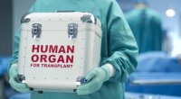 Azərbaycanda neçə nəfər orqan transplantasiyası gözləyir? - Rəsmi AÇIQLAMA