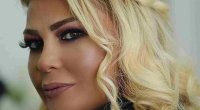Estetik əməliyyat etdirən Əməkdar artist TANINMAZ HALDA - VİDEO