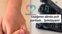 Bakıda azyaşlının əlində pult partladı